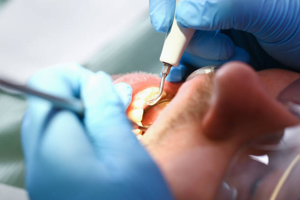 Best Emergency Gum Pain Relief  in Chatsworth, IL